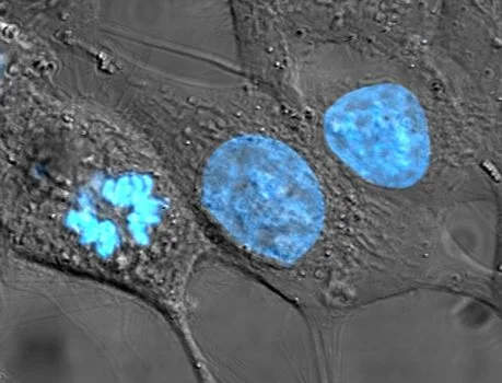 Células HeLa teñidas para microscopía de fluorescencia, la primera línea de células humanas inmortalizada en cultivo